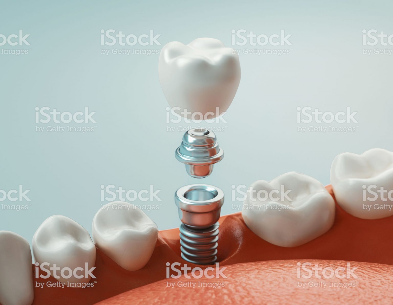 istockphoto-1153624021-2048x2048-1-1536x1193