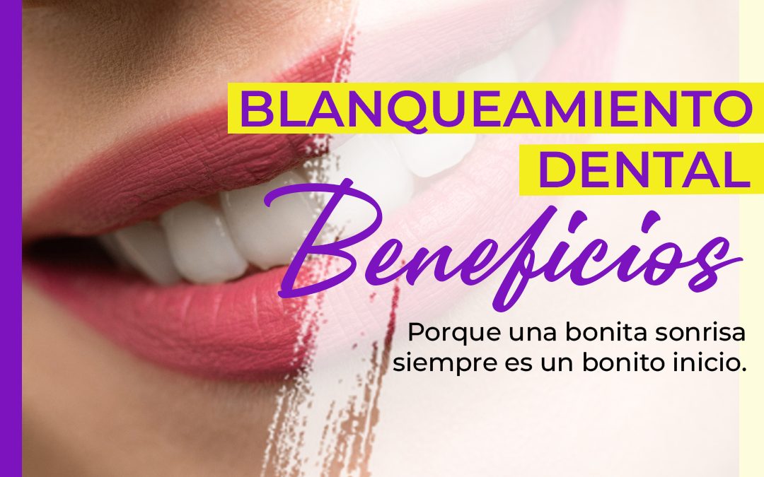 Principales beneficios del blanqueamiento dental